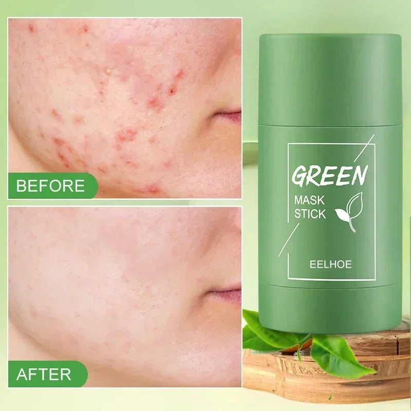 Green Tea Clean Mask Stick Acne - Tratamento para remover cravos e acnes